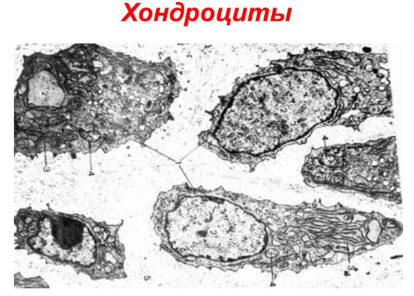 Куркума. Польза и вред, как принимать в лечебных целях, для похудения, здоровья суставов, волос, лица. Рецепты