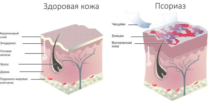 Куркума. Польза и вред, как принимать в лечебных целях, для похудения, здоровья суставов, волос, лица. Рецепты