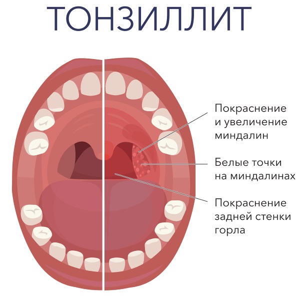 Куркума. Польза и вред, как принимать в лечебных целях, для похудения, здоровья суставов, волос, лица. Рецепты